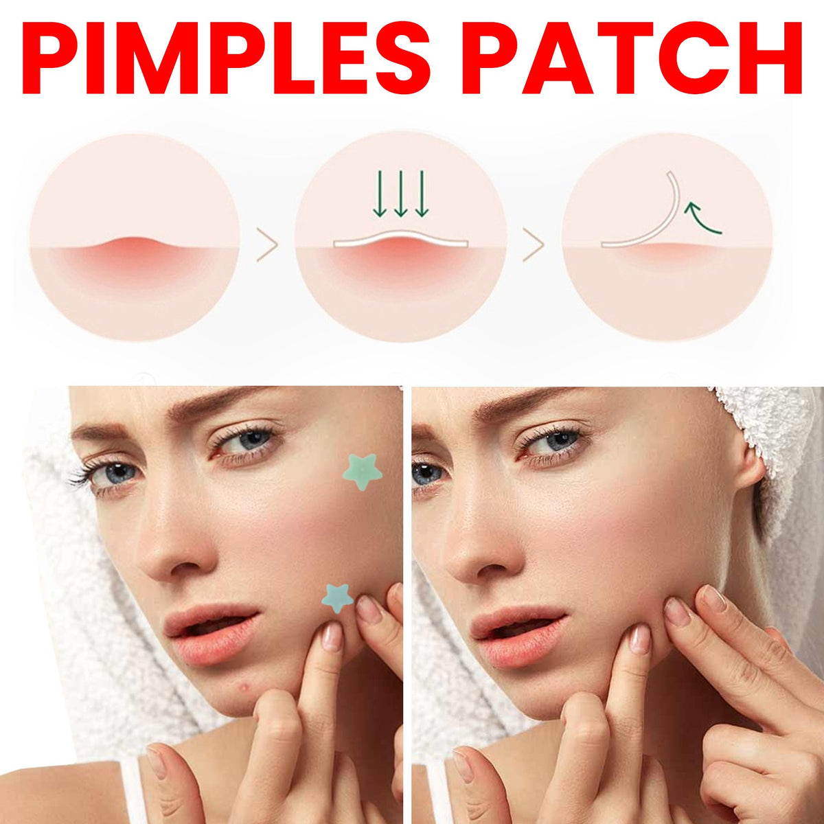 Adesivos para Acne 200 unidades