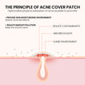 Adesivos para Acne 200 unidades