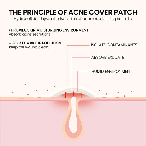 Adesivos para Acne 200 unidades